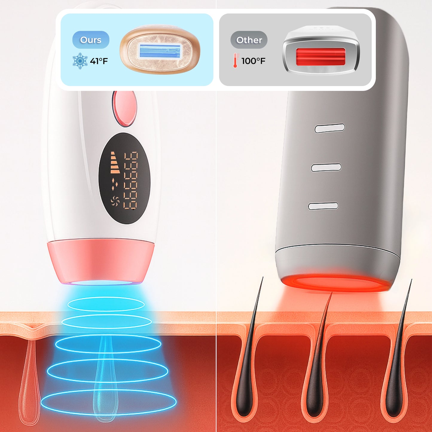 IPL Hair Laser Removal