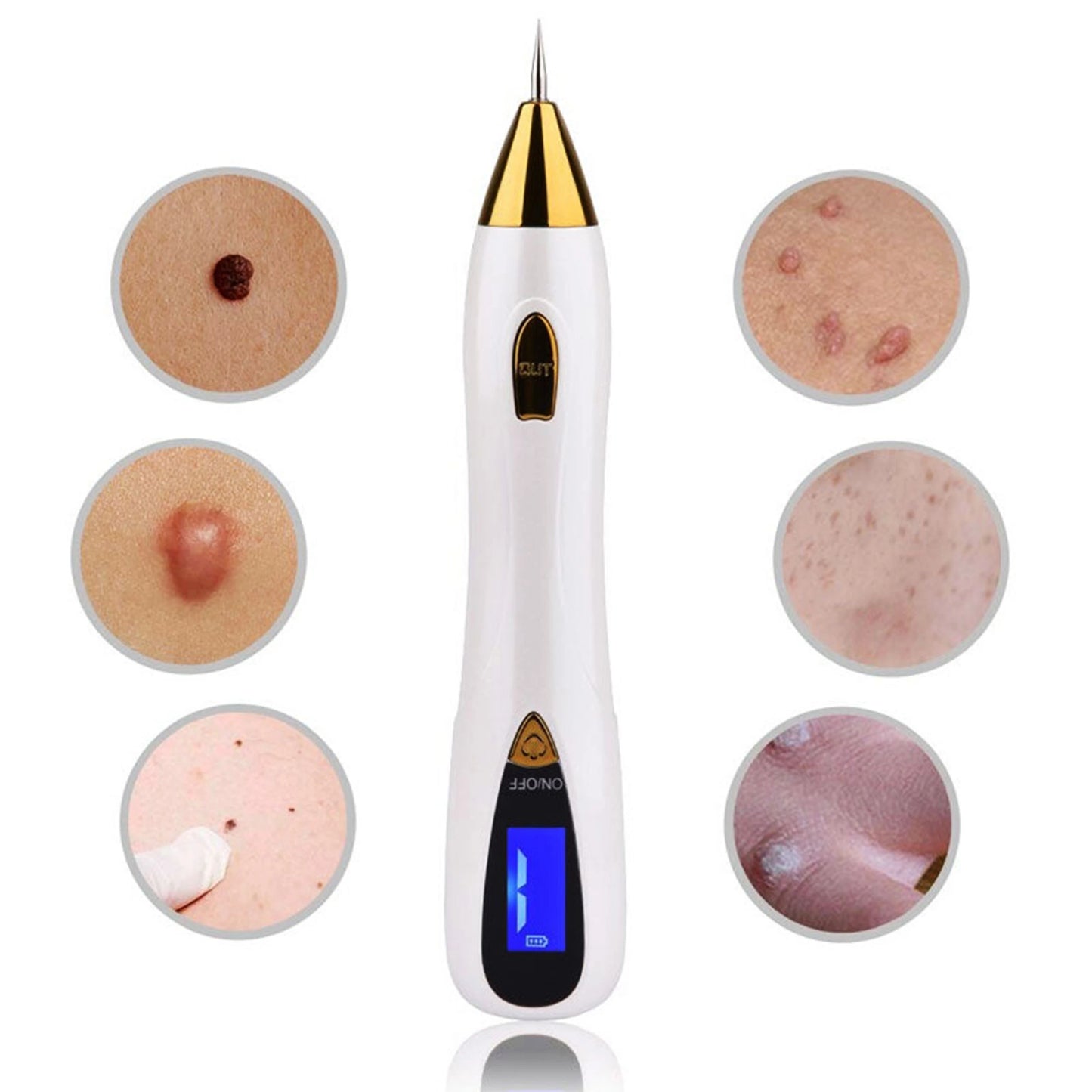 Remover Pen for Moles
