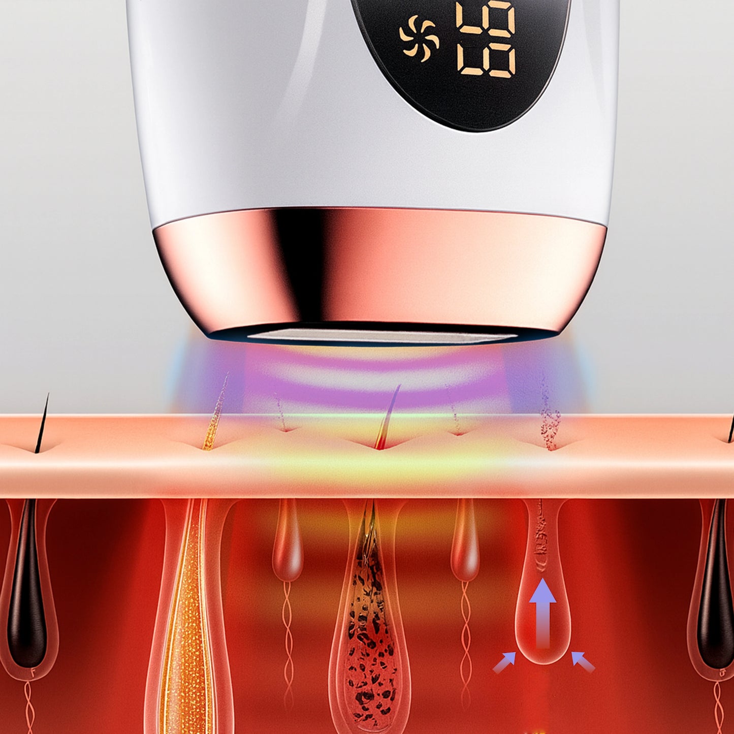 IPL Hair Laser Removal