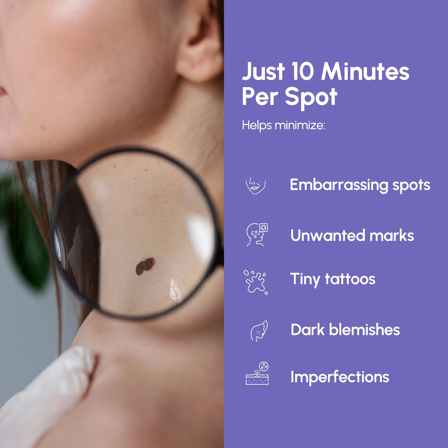 Remover Pen for Moles