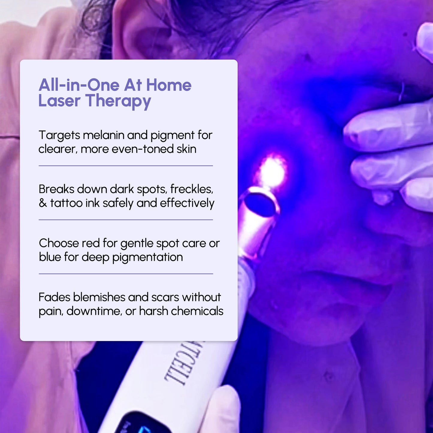 Picosecond Laser Pen