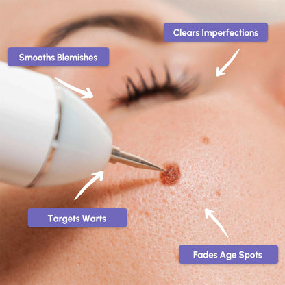 Remover Pen for Moles