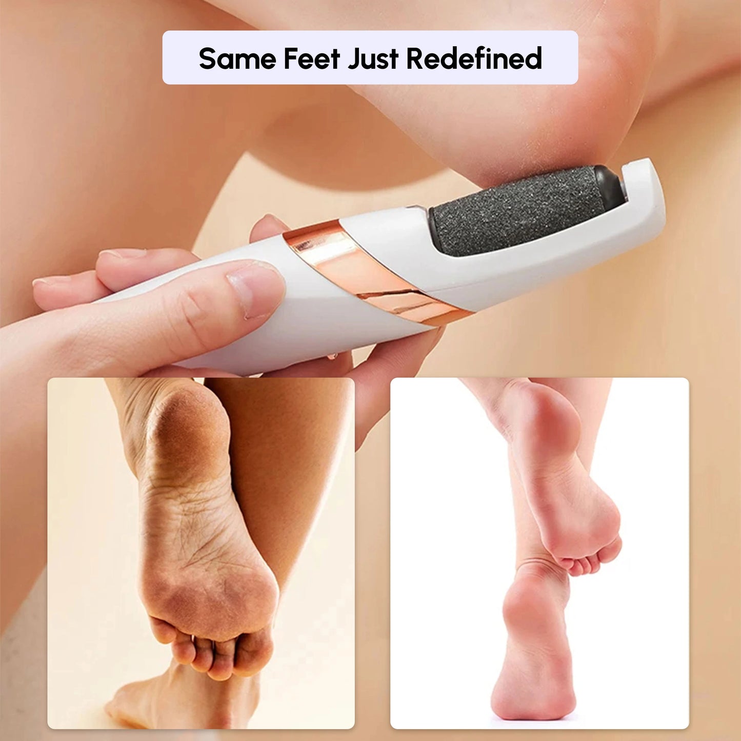 Best Electric Foot File